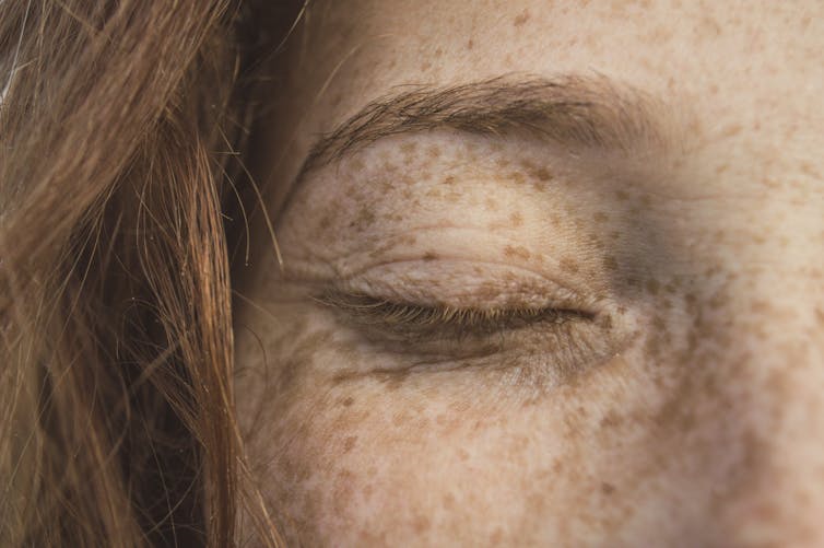 Freckles over a woman's face